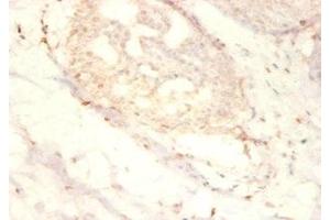 Immunohistochemistry of paraffin-embedded human mammary gland tissue using ABIN7169869 at dilution of 1:50 (SNRPG antibody  (AA 1-76))