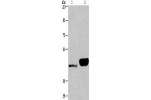 Gel: 6 % SDS-PAGE, Lysate: 40 μg, Lane 1-2: Human endometrial cancer tissue, Human placenta tissue, Primary antibody: ABIN7190562(ENPP4 Antibody) at dilution 1/200, Secondary antibody: Goat anti rabbit IgG at 1/8000 dilution, Exposure time: 40 seconds (ENPP4 antibody)