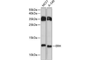 Western blot analysis of extracts of various cell lines, using ERH antibody (ABIN6133507, ABIN6140284, ABIN6140286 and ABIN6215884) at 1:3000 dilution. (ERH antibody  (AA 1-104))