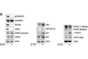 ETO regulates SAMHD1 phosphorylation through the p53, p21 pathwayMDM were treated with increasing concentrations of ETO and CTH.