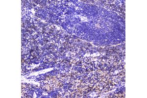 IHC analysis of NCR1 using anti-NCR1 antibody . (NCR1 antibody  (AA 22-258))