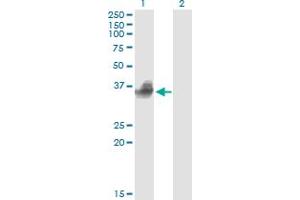 Western Blot analysis of FCGR2B expression in transfected 293T cell line by FCGR2B monoclonal antibody (M02A), clone 1A9. (FCGR2B antibody  (AA 45-154))