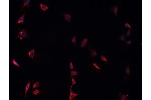 ABIN6268837 staining U-251 MG cells by IF/ICC. (Galectin 9 antibody  (Internal Region))