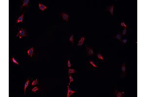 ABIN6268837 staining U-251 MG cells by IF/ICC.