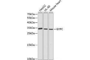 Western blot analysis of extracts of various cell lines using GYPC Polyclonal Antibody at dilution of 1:1000. (CD236/GYPC antibody)