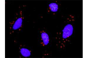 Proximity Ligation Analysis of protein-protein interactions between HDAC2 and PPARD. (HDAC2 antibody  (AA 1-582))