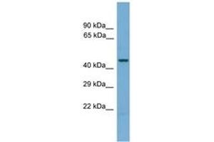 Image no. 1 for anti-Pseudouridylate Synthase 1 (PUS1) (AA 21-70) antibody (ABIN6744593) (PUS1 antibody  (AA 21-70))