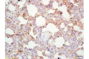 Formalin-fixed and paraffin embedded mouse lung labeled with Rabbit Anti Integrin alpha 4/CD49d/Integrin ? (ITGA4 antibody  (AA 551-650))