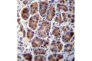 Immunohistochemistry analysis in formalin fixed and paraffin embedded human stomach tissue reacted with MAN2A2 Antibody (Center) followed which was peroxidase conjugated to the secondary antibody and followed by DAB staining. (MAN2A2 antibody  (Middle Region))