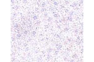 Immunohistochemistry of TEM7 in mouse liver tissue with this product at 2. (PLXDC1 antibody  (C-Term))