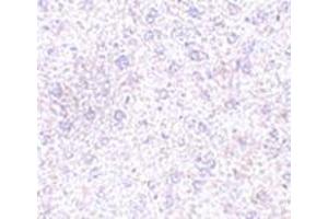 Immunohistochemistry of TEM7 in mouse liver tissue with this product at 2.