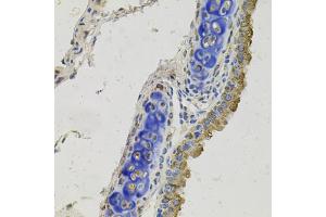 Immunohistochemistry of paraffin-embedded mouse lung using GAS6 antibody. (GAS6 antibody)