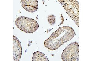 IHC analysis of TEK using anti-TEK antibody (ABIN7600762). (TEK antibody  (AA 23-616))