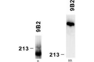 Western Blotting (WB) image for anti-Laminin, alpha 4 (LAMa4) antibody (ABIN781771) (LAMa4 antibody)