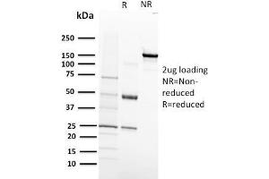 SDS-PAGE Analysis Purified VEGF-R1 Mouse Monoclonal Antibody (FLT1/658). (FLT1 antibody)