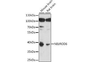 Western blot analysis of extracts of various cell lines, using NEUROD6 antibody (ABIN7268868) at 1:1000 dilution. (NEUROD6 antibody  (AA 188-337))