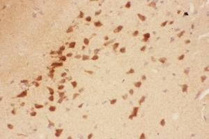 Anti-BDNF Picoband antibody,  IHC(P): Rat Brain Tissue (BDNF antibody  (AA 129-247))