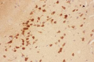 Anti-BDNF Picoband antibody,  IHC(P): Rat Brain Tissue