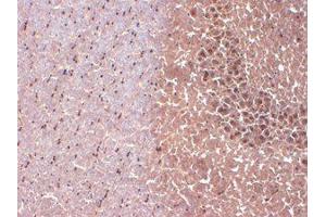 Immunohistochemistry (IHC) image for anti-Sodium Channel, Voltage-Gated, Type I, alpha Subunit (SCN1A) (C-Term) antibody (ABIN6658122)