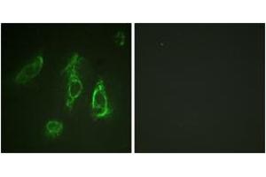 Immunofluorescence analysis of HeLa cells, using Epo-R (Ab-368) Antibody. (EPOR antibody  (AA 341-390))