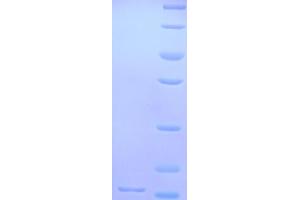 GLRa2 Protein (AA 27-143, Extracellular) (His tag)