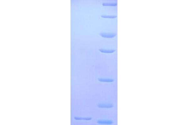 GLRa2 Protein (AA 27-143, Extracellular) (His tag)