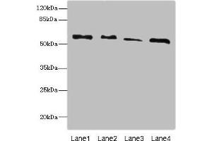 Western blot All lanes: RTKN antibody at 4.
