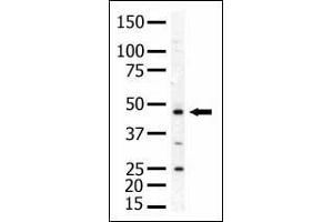 The anti-PIP4K2A Pab (ABIN392597 and ABIN2842126) is used in Western blot to detect PIP4K2A in mouse skeletal muscle tissue lysate. (PIP4K2A antibody  (N-Term))