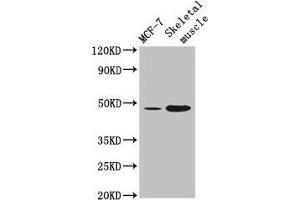 Western Blot Positive WB detected in: MCF-7 whole cell lysate, Mouse skeletal muscle tissue All lanes: ARRDC3 antibody at 4 μg/mL Secondary Goat polyclonal to rabbit IgG at 1/50000 dilution Predicted band size: 47 kDa Observed band size: 47 kDa (ARRDC3 antibody  (AA 1-270))