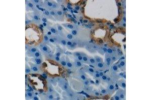 Immunohistochemical analysis of HSD3B7 staining in human kidney formalin fixed paraffin embedded tissue section. (HSD3B7 antibody)