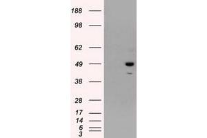 Western Blotting (WB) image for anti-Proteasome (Prosome, Macropain) 26S Subunit, ATPase, 3 (PSMC3) antibody (ABIN1501336) (PSMC3 antibody)