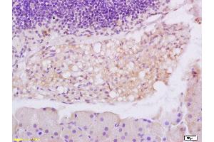 Formalin-fixed and paraffin embedded rat colitis tissue labeled with Anti-phospho-eIF4EBP1 (Thr37/46) Polyclonal Antibody, Unconjugated 1:200 followed by conjugation to the secondary antibody and DAB staining