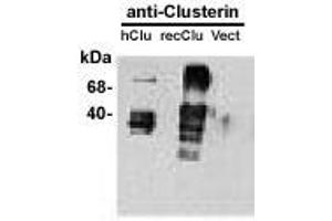 Image no. 1 for anti-Clusterin (CLU) antibody (ABIN187541) (Clusterin antibody)