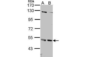 WB Image Sample (30 ug of whole cell lysate) A: 293T B: A431 , 7. (IFNAR2 antibody  (Center))