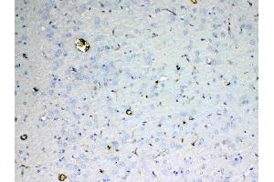 IHC analysis of ADA using anti-ADA antibody . (ADA antibody  (AA 2-241))