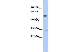 RD3 antibody used at 1 ug/ml to detect target protein. (RD3 antibody  (N-Term))