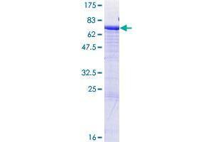 CD177 Protein (AA 1-437) (GST tag)