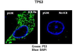 Sample Type: Rat thyrocytes-FRTL-5  Primary Antibody Dilution: 1:100 Secondary Antibody: Anti-rabbit-FITC  Secondary Antibody Dilution: 1:000 Color/Signal Descriptions: Green: TP53RKBlue: DAPI  Gene Name: TP53RK Submitted by: Syed A Morshed, Mount Sinai School of Medicine and James J Peters VA Medical Center (TP53RK antibody  (N-Term))