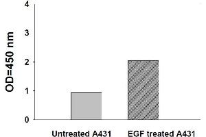 EPH Receptor B3 ELISA Kit