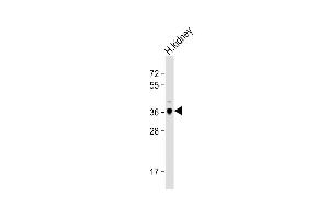 Anti-LGMN Antibody (N-term) at 1:1000 dilution + human kidney lysate Lysates/proteins at 20 μg per lane. (LGMN antibody  (N-Term))