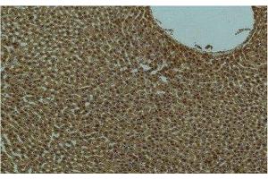 Immunohistochemistry of paraffin-embedded Rat liver tissue using PI 3 kinase p85 alpha Monoclonal Antibody at dilution of 1:200. (PIK3R1 antibody)