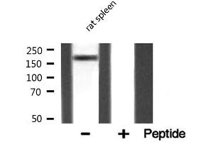 Western blot analysis of MAST2 expression in Rat spleen lysate (MAST2 antibody  (Internal Region))