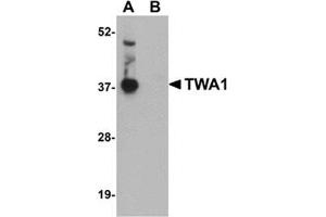 Western blot analysis of TWA1 in human brain tissue lysate with this product at 1 μg/ml in (A) the absence and (B) the presence of blocking peptide. (TTC5 antibody  (C-Term))