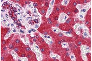 Immunohistochemistry (IHC) image for anti-Cytochrome B5 Type A (Microsomal) (CYB5A) (AA 1-135) antibody (ABIN961212)