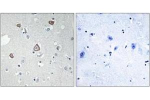 Immunohistochemistry analysis of paraffin-embedded human brain tissue, using GRM2 Antibody. (GRM2 antibody  (AA 241-290))
