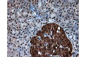 Immunohistochemical staining of paraffin-embedded colon tissue using anti-ACLY mouse monoclonal antibody.
