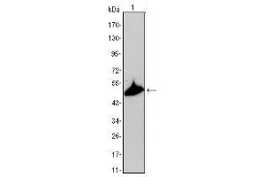Western blot analysis using KRT15 mouse mAb against A431 cell lysate. (KRT15 antibody)