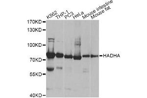 Western blot analysis of extracts of various cell lines, using HADHA antibody (ABIN6292979) at 1:1000 dilution. (HADHA antibody)