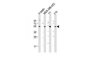 All lanes : Anti-WDR51B Antibody (C-term) at 1:2000 dilution Lane 1: human testis lysate Lane 2: MDA-MB-453 whole cell lysate Lane 3: TT whole cell lysate Lane 4: Y79 whole cell lysate Lysates/proteins at 20 μg per lane.