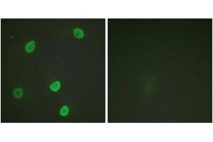 Immunofluorescence analysis of HeLa cells, using Histone H4 (Acetyl-Lys8) Antibody. (Histone H4 antibody  (acLys8))